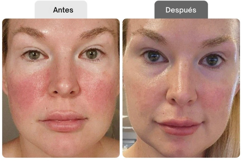 <p>Resultados probados por clientas reales</p>