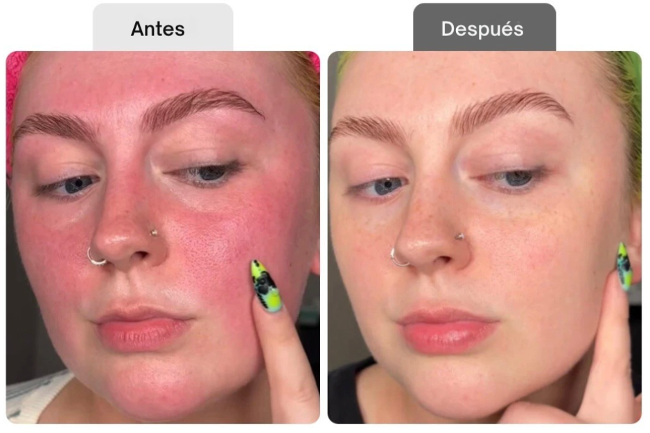 <p>Resultados probados por clientas reales</p>
