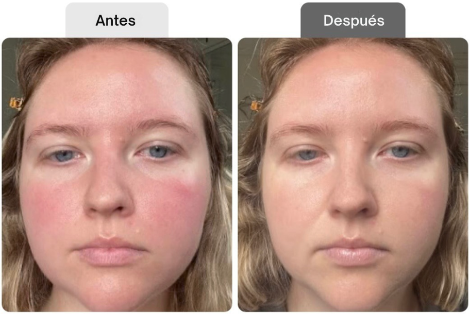 <p>Resultados probados por clientas reales</p>