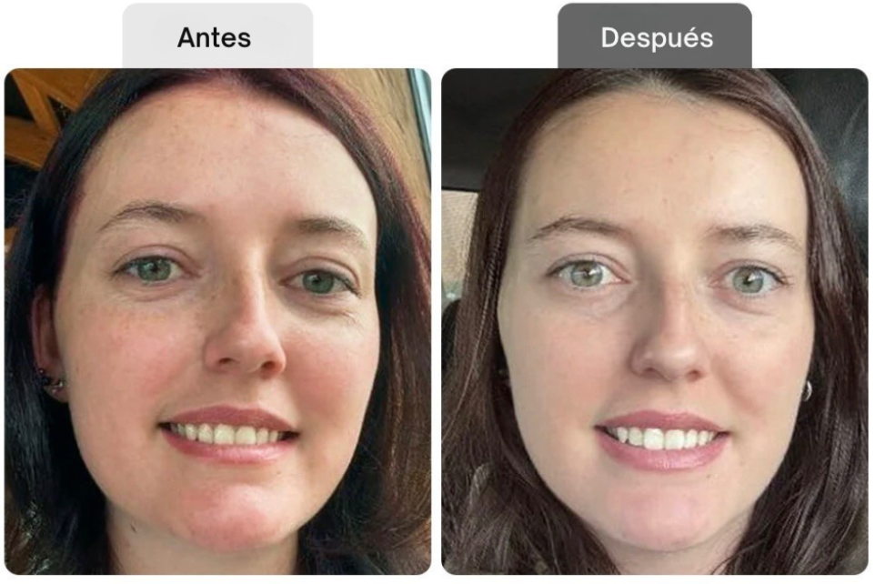 <p>Resultados probados por clientas reales</p>